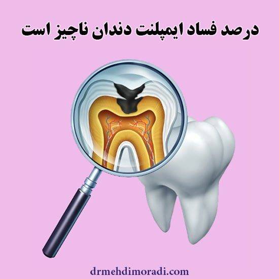 محاسن ایمپلنت دندان